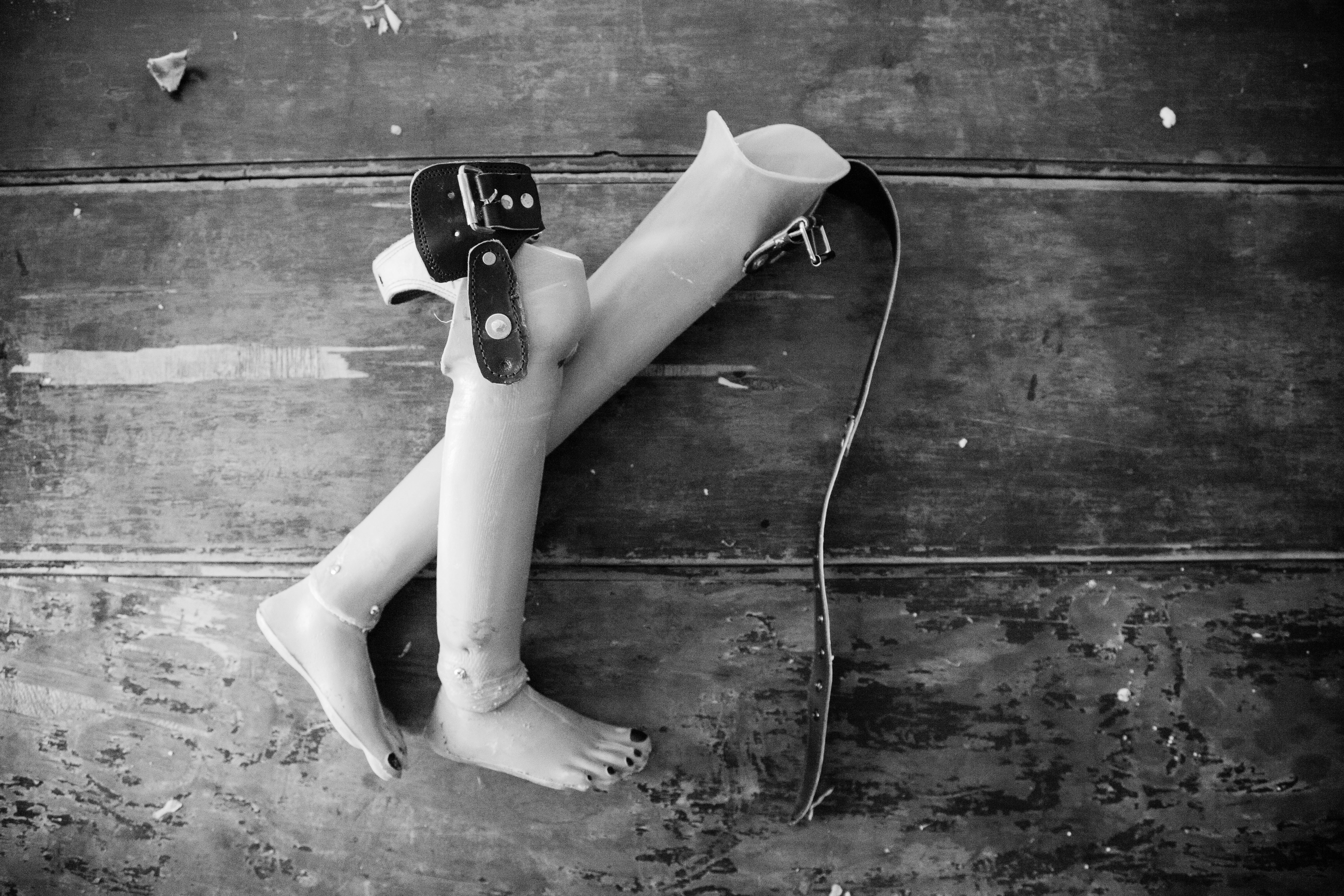 Extendable Leg Prosthetic